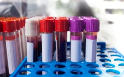 RFID İle Kan Numune Tüpü Takibi